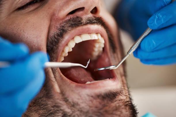Best Emergency Broken Tooth Repair in Leland Grove, IL